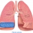 Astmul bronşic. Actualităţi în tratament